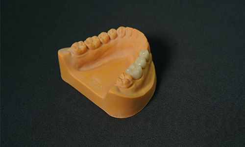 Cobalt-chrome Porcelain Teeth