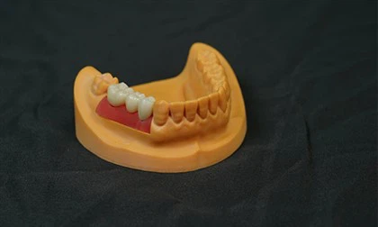 Sert çene pedlerinin kalınlığı homojen midir?